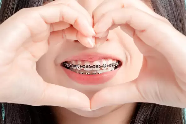 https://www.bigsmile.com.sg/wp-content/uploads/2021/11/the-different-parts-of-metal-braces-and-what-they-are-for.webp